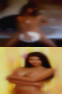 Due to HIV naked girls med.